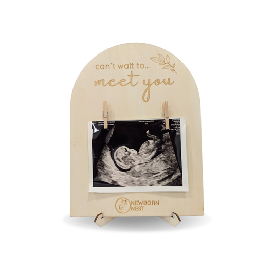 How to Display Ultrasound Photos Without Damaging the Originals